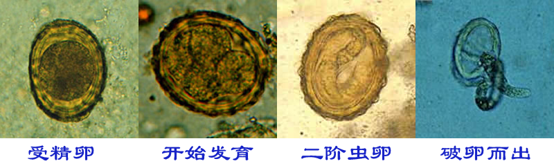 变态的蛔虫