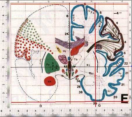 科学网—人脑神经解剖图谱（neuroanatomical atlas） - 刘明进的博文
