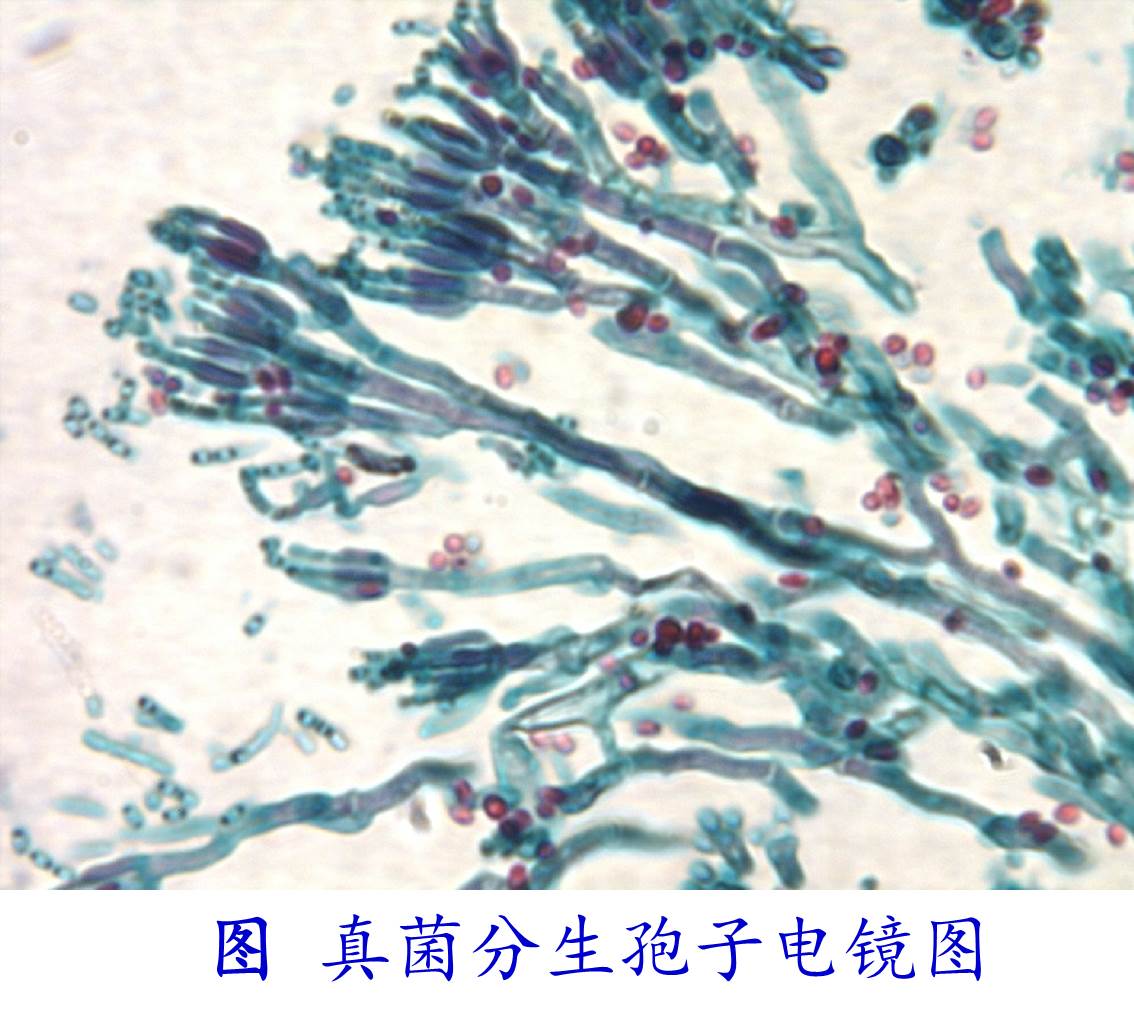 细菌孢子图册_360百科