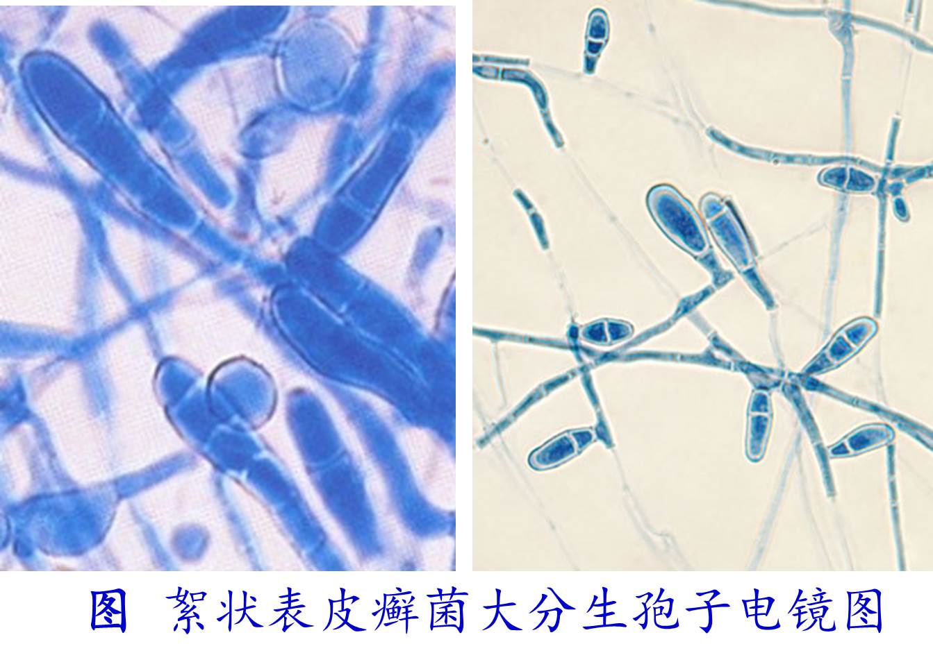 丛枝菌根真菌(AMF)孢子、菌丝密度及侵染率定量测定方法 —BIO-101