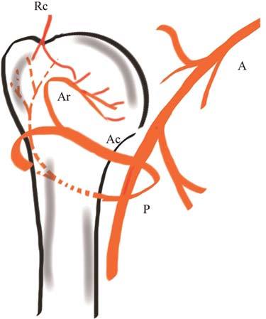 肩关节肱骨近端骨折后肱骨头坏死血供基础旋肱前动脉重要还是旋肱后