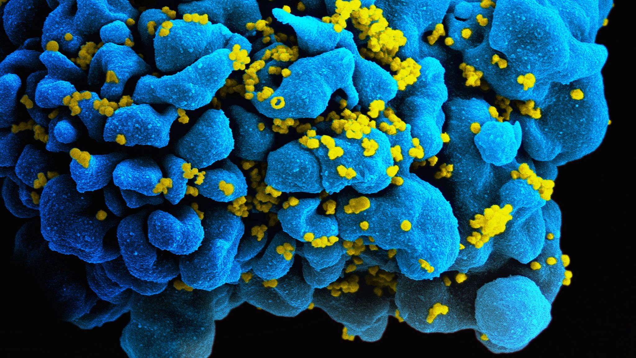 HIV_H9_T-cell.jpg