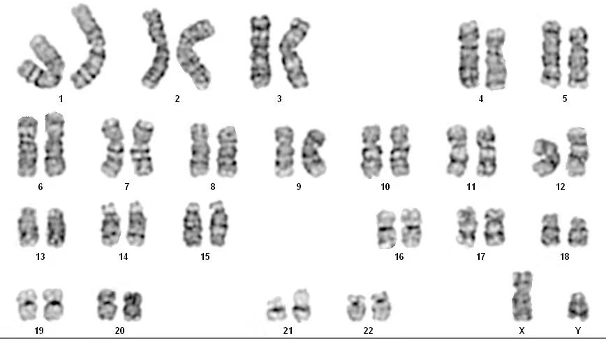 karyotype-2.jpg