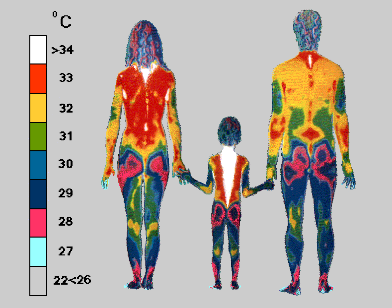 family1-infrared-thermogram.gif