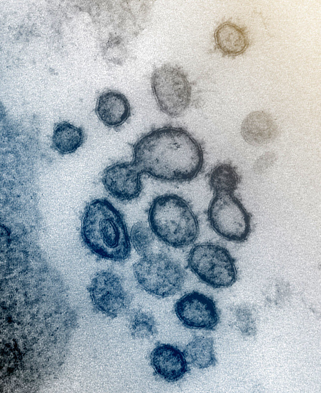 4-coronavirusc.jpg