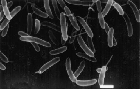 Scanning-electron-micrograph-of-Roseburia-intestinalis-sp.png