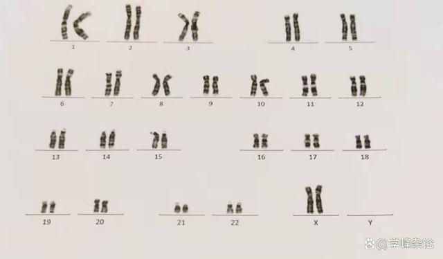 一位妇人的染色体组成的核型.jpg