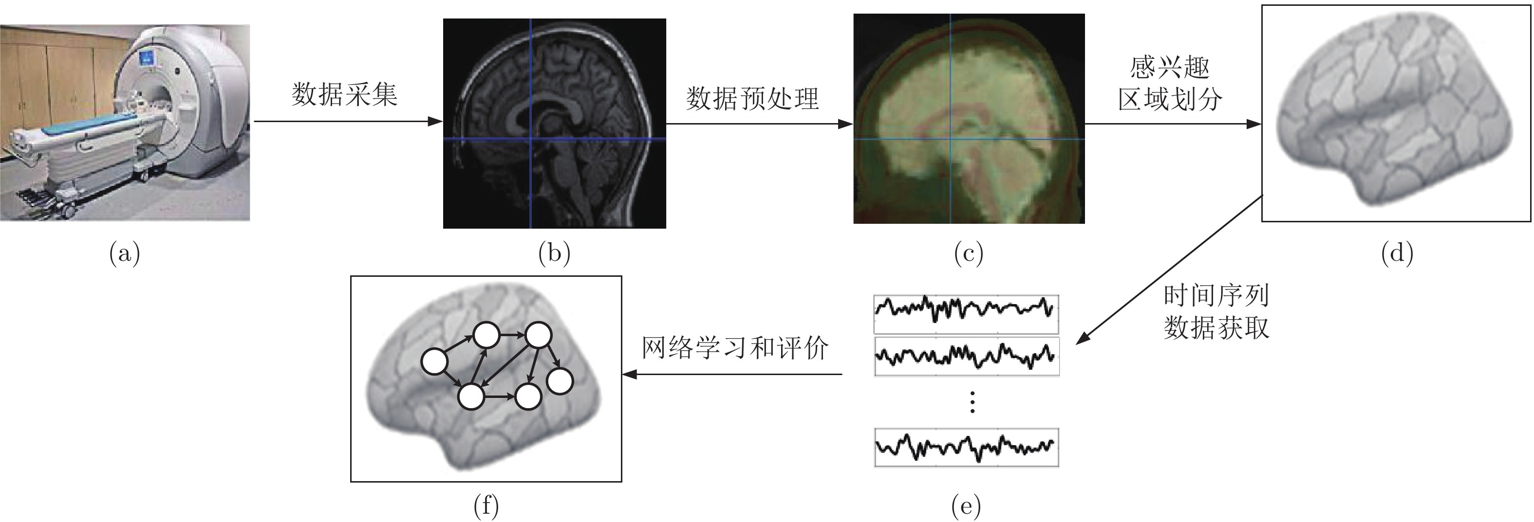 Nature neuroscience：功能核磁共振成像(fMRI)分析的计算方法-南京思影科技有限公司