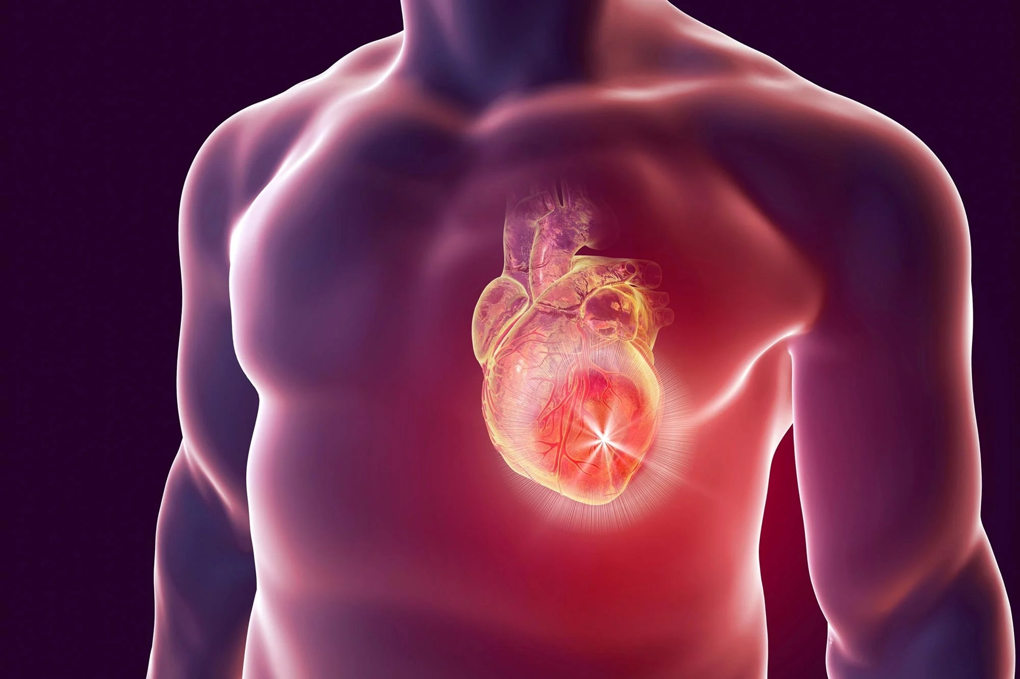 Man-Heart-Attack-Cardiology-Illustration.webp.jpg