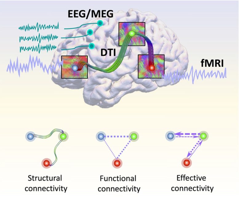 Depictions-of-Connections-in-a-Brain-Connectome-and-the-Resulting-Three-Types-of.jpg
