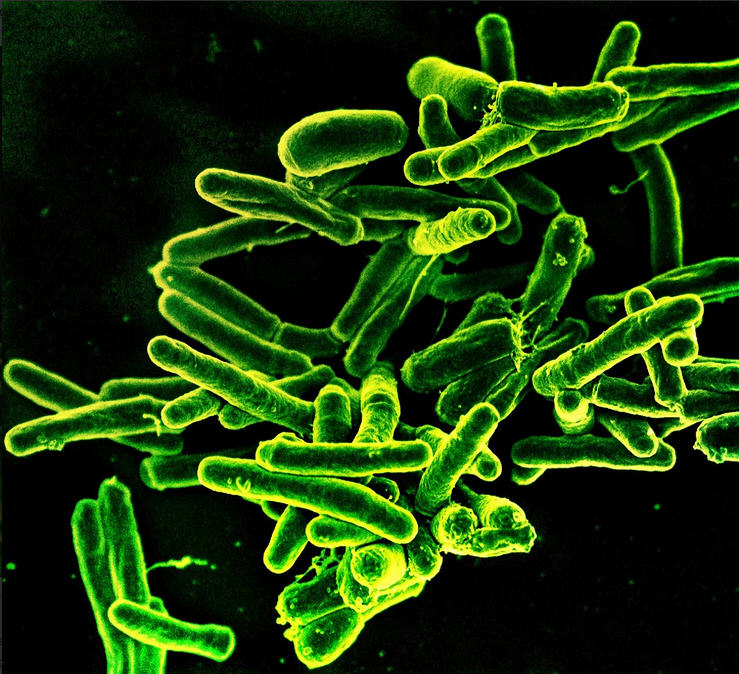 Mycobacterium-Tuberculosis-Bacteria-Green.jpg