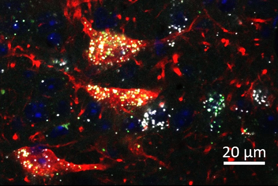 Midbrain-Neurons-Co-Expressing-the-Mu-Opioid-Receptor-and-Cannabinoid-Receptor-1.jpg