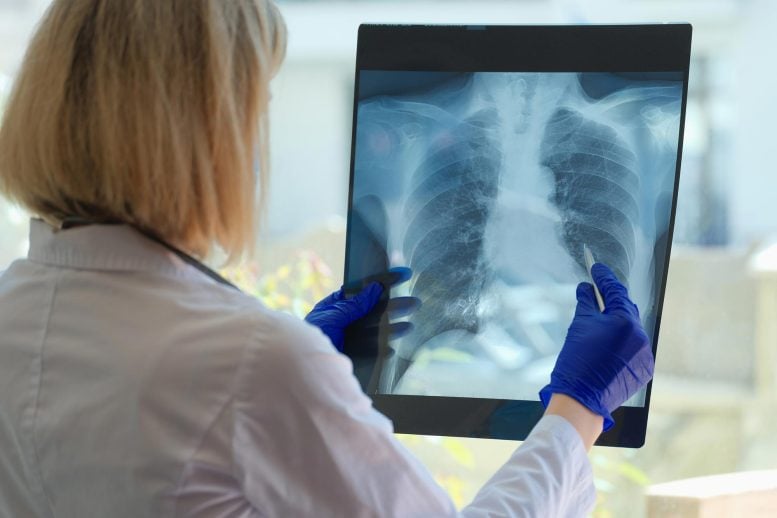 Doctor-Examines-Lung-Patient-X-Ray-777x518.jpg