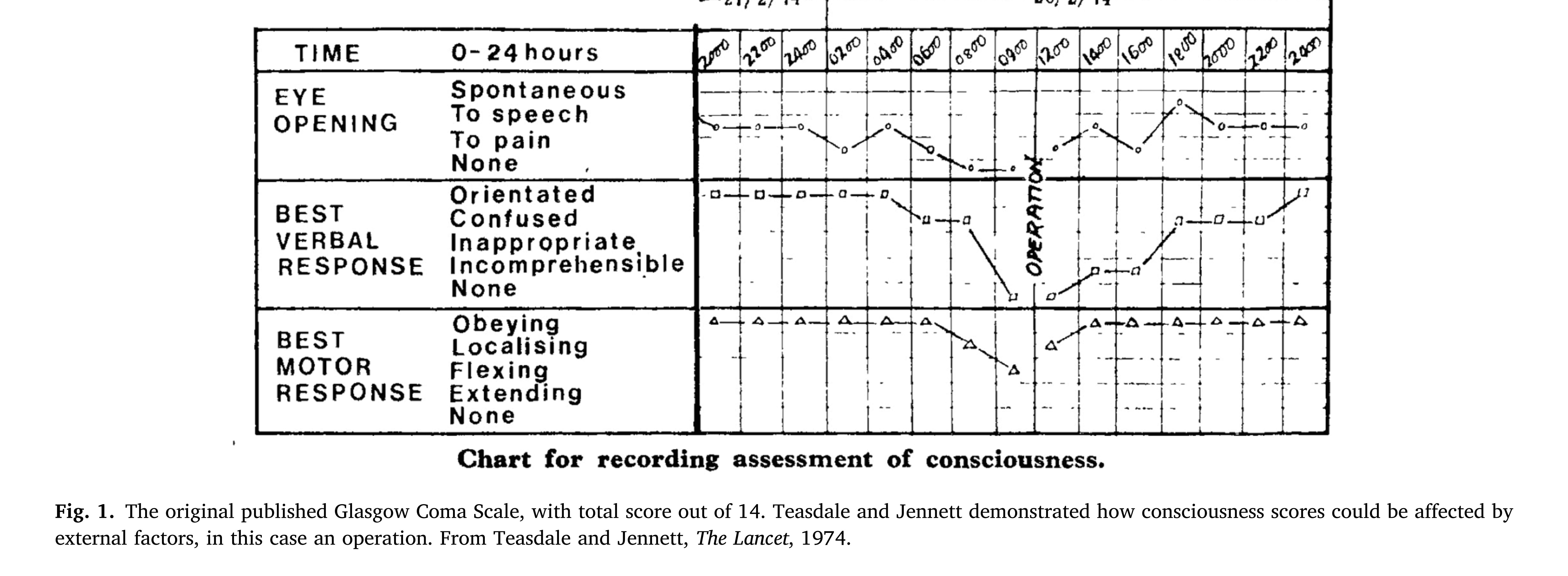 50 Years of the Glasgow Coma Scale A historical perspective_02.jpg