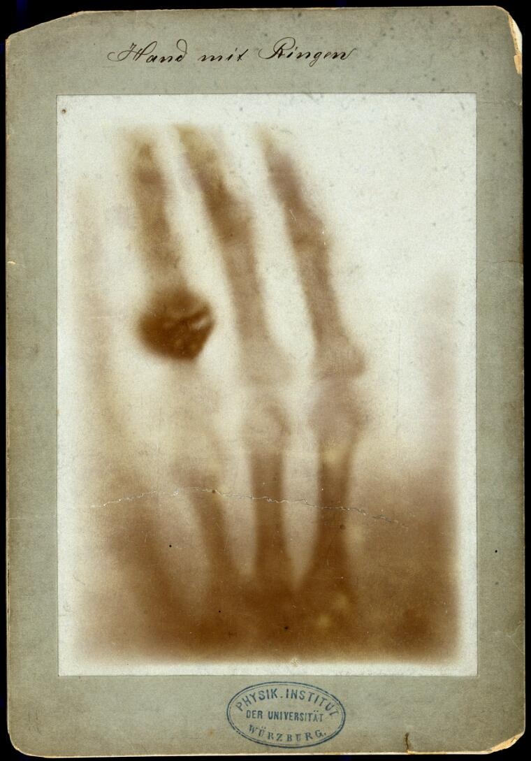 image-05-xray-hand_hires.jpg