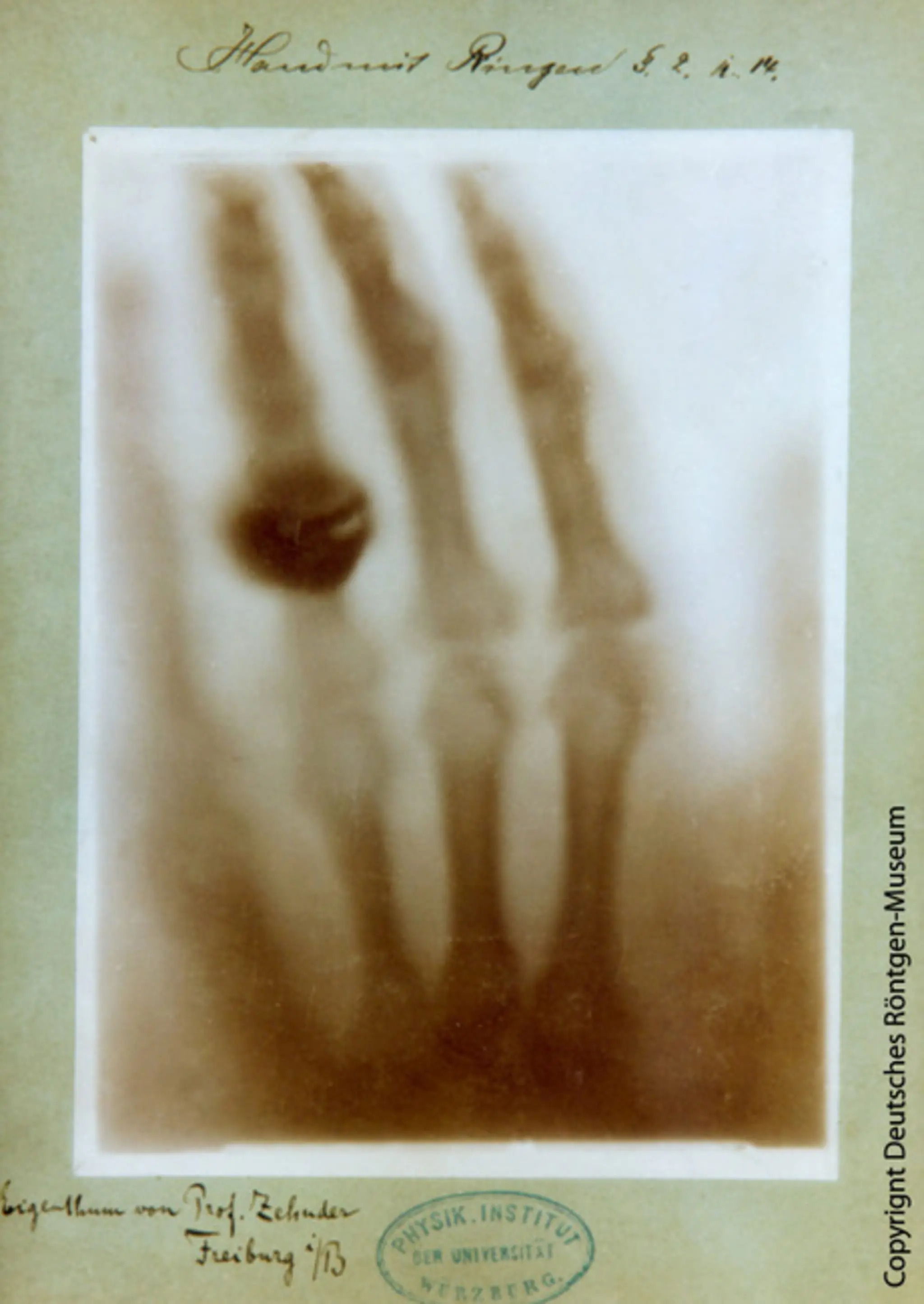 Bertha-Roentgens-Hand-1895-copy-Deutsches-Roentgenmuseum.jpg