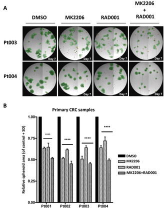Amphotericin B������ϸ��Ĥ�Ķ�Ч�����أ��ڿ���Ⱦ����������.png