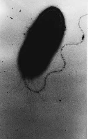 变形杆菌周鞭毛图片