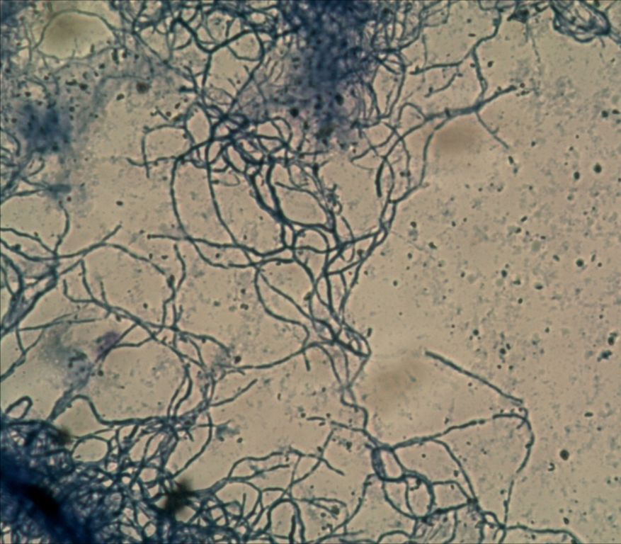 放线菌培养皿菌落形态图片