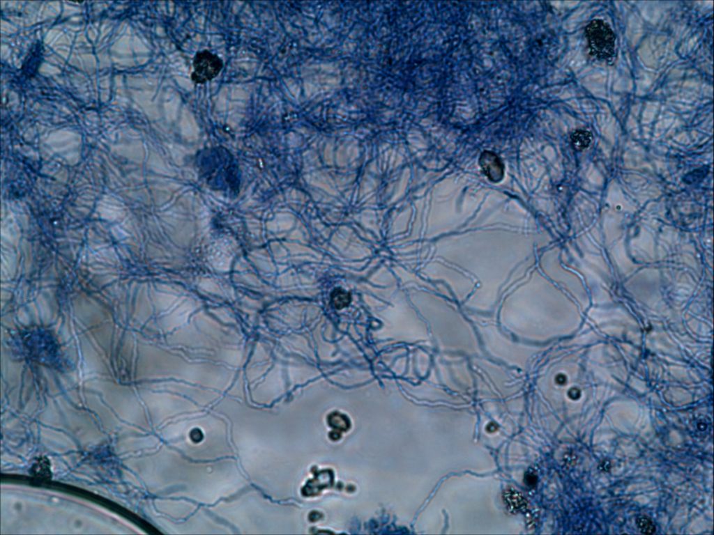 放线菌图片大全显微镜图片