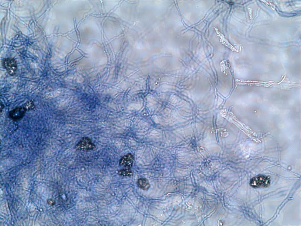 放线菌100倍显微镜图片图片