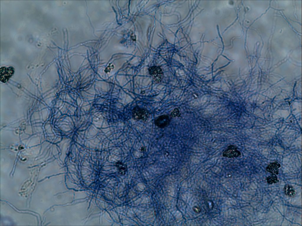 放线菌电镜图图片