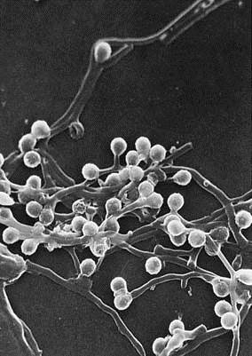 放线菌显微镜观察图片