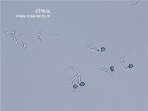 科学网—0y34.jpg 弯孢炭疽菌萌发ck