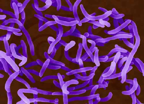 科学网—志贺氏菌 - ruying7764的相册