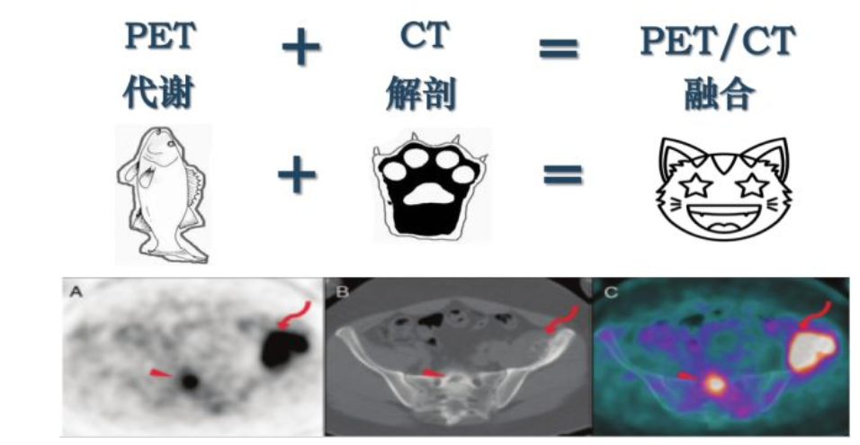 科学网—[转载]电子发射断层显像PET (Positron Emission Tomography)与PET/CT - 高琳琳的博文