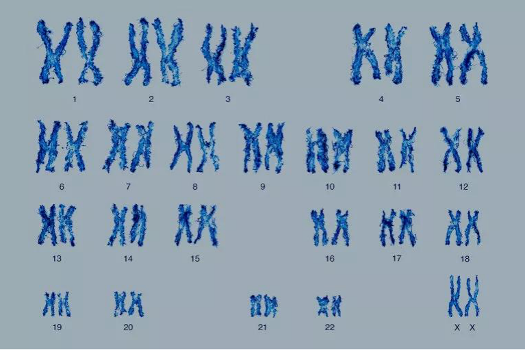 人类染色体组图图片