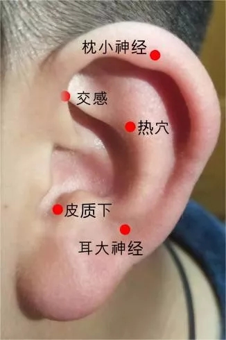 丘脑在耳朵的哪个位置图片